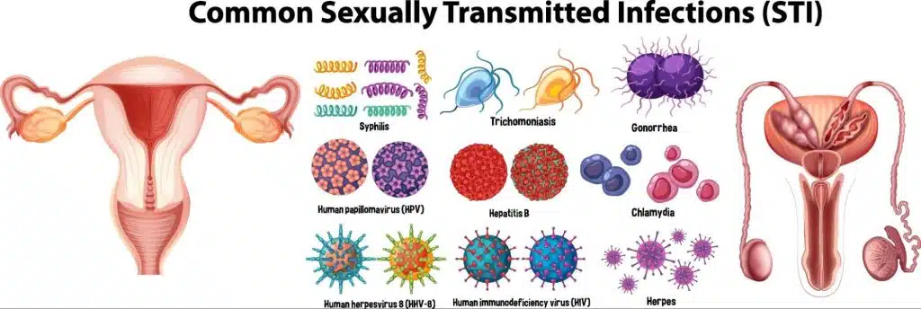 Understanding STIs